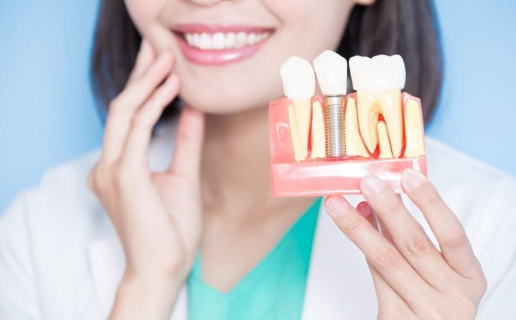 Dental Implants vs Bridges